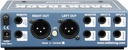 Radial Backtrack feature panel 2